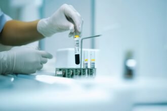 A NIFTY teszt vérmintája terhességi szűréshez