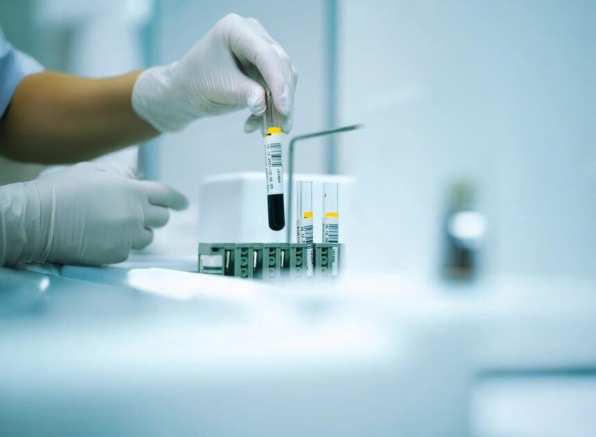 A NIFTY teszt vérmintája terhességi szűréshez